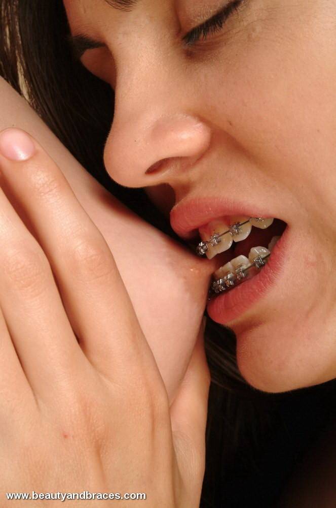 Two cuties with braces nibbling and sucking at each other - #6